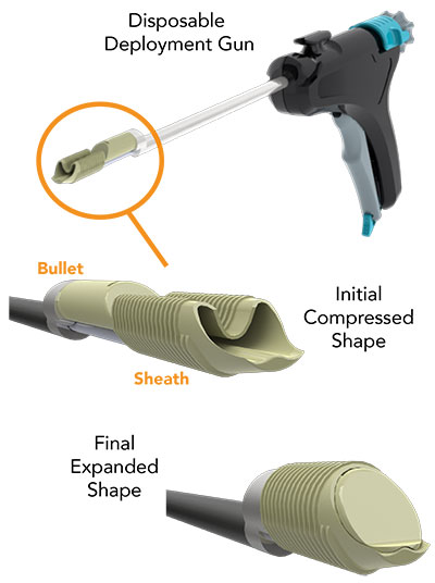 Eclipse - Features & Benefits as a Soft Tissue Fixation & Tenodesis Device